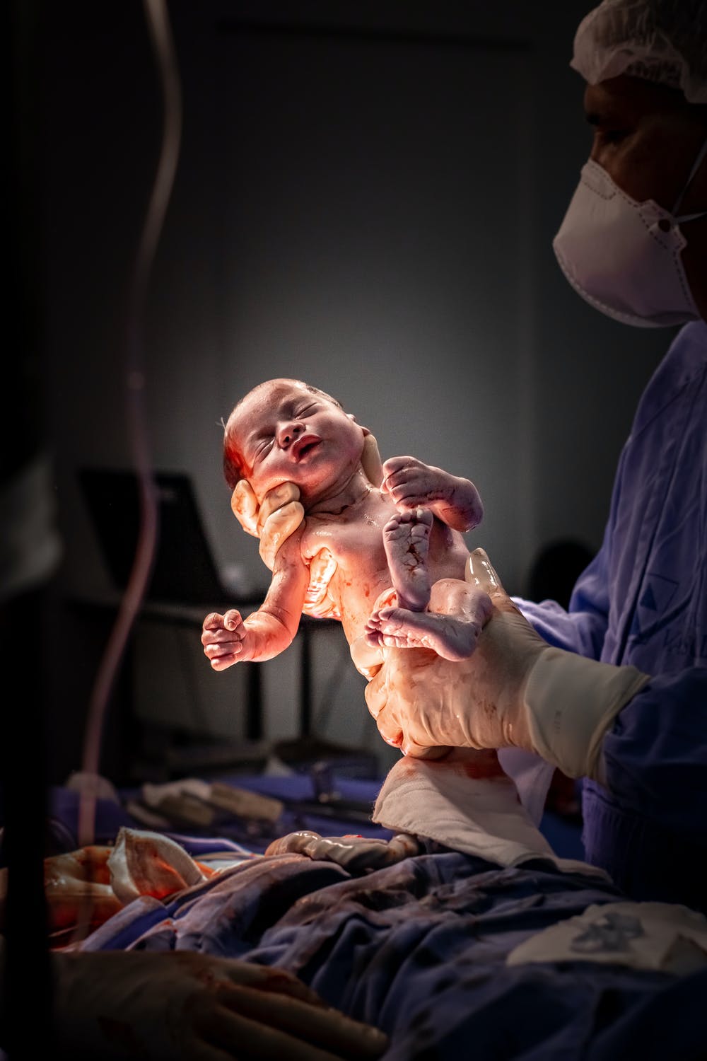 Your Caesarean Birth Plan  image