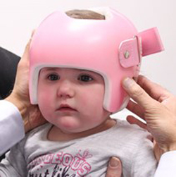 Everything you need to know about Flat Head Syndrome  image