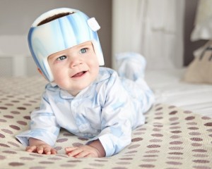 A baby wearing a TiMband (a form of plagiocephaly helmet).