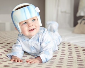 Everything You Need To Know About Flat Head Syndrome  image